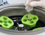 Curso de Biomedicina: Mão enluvada de um aluno com jaleco branco Unoeste, insere um tubo de ensaio com líquido amarelo em uma centrífuga, em um laboratório moderno, compondo um cenário de aula prática, limpo e organizado.